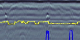robot radar ispezione tubature